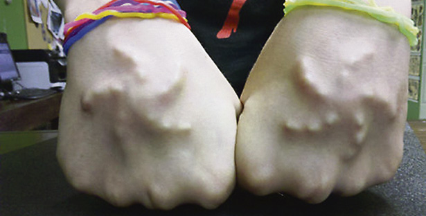 Fotos archivo EL HERALDO