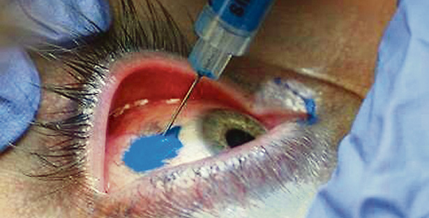 Fotos archivo EL HERALDO