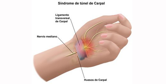 Fotos archivo EL HERALDO