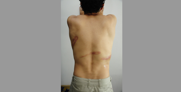 Fotos archivo EL HERALDO