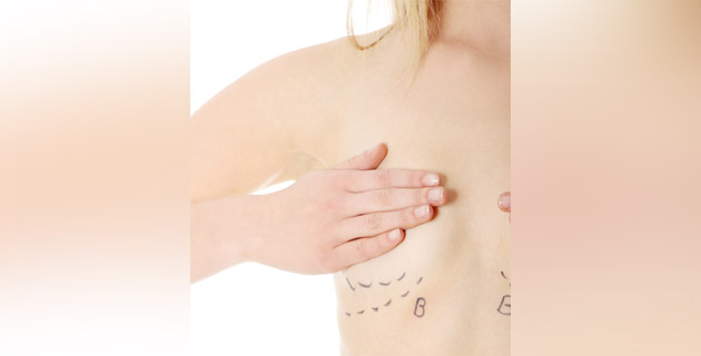 Fotos archivo EL HERALDO